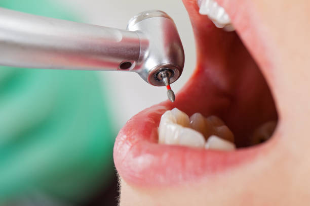 Best After-Hours Emergency Dentist in Foreman, AR